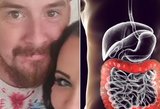 37-erių vyrui smogė žarnyno vėžys: štai, kokie simptomai jį išdavė