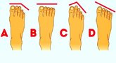 Pėdos pirštų ilgis gali atskleisti ir slaptas charakterio savybes  