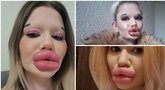Didžiausių lūpų savininkė pasaulyje sustoti neketina: tobulins kitą kūno vietą (tv3.lt fotomontažas)