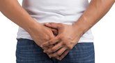 Prostatos ligos (nuotr. Shutterstock.com)