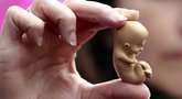 Prahos ligoninė per klaidą moteriai atliko abortą  (nuotr. SCANPIX)