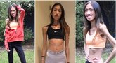 19-metė svėrė vos 30 kilogramų: nepatikėsite, kaip ji atrodo dabar (nuotr. Instagram)  