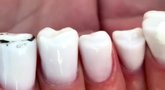 Dantų formos nagai (nuotr. Instagram)