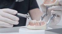 Tą žino ne visi: senjorams dantų implantacija yra kompensuojama (nuotr. stop kadras)