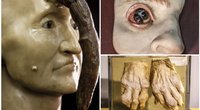 Deformuoti kūnai ir ir kūdikiai stiklainiuose: chirurgo eksperimentai kelia siaubą (Mütter Museum of Philadelphia nuotr.) (nuotr. Organizatorių)