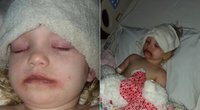 Košmarą patyrusios 3-metės mama kreipiasi į žmones: paviešino šias nuotraukas  