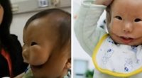 Kinijoje žiniasklaida šį mažylį vadina „vaiku su dviem veidais“.  