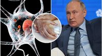 Prakalbo apie Putino sveikatą  (tv3.lt fotomontažas)