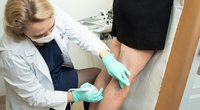 Kraujagyslių gydytoja Žana Kavaliauskienė atlieka ultragarso tyrimą (nuotr. Gijos klinikų)  