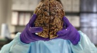 Mokslininkai aptiko smegenų sritį, kurią pažeidus išauga religingumas (nuotr. SCANPIX)