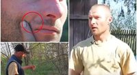 Į veidą pašautą vyrą rusai palaidojo gyvą: pats išlipo iš duobės ir grįžo namo (nuotr. Twitter)