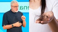 Unikauskas atsakė į žiūrovės klausimą: štai, kas sukelia plaukų slinkimą  