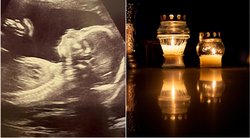 Negimusiems mirusiems kūdikiams Šiluvoje ruošiamas specialus kapas: „Tai yra visgi žmogaus embrionas“ (tv3.lt koliažas)