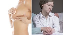 Krūties vėžys (nuotr. 123rf.com)