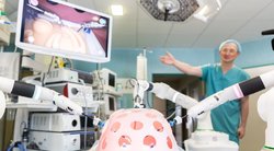 Lietuvos medicina žengia į naują erą: vėžiui ir kitoms ligoms operuoti pasitelkia robotą BNS Foto