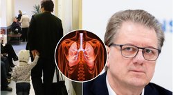 Profesorius Čaplinskas – apie plintantį „baltųjų plaučių“ sindromą: štai kam pavojingiausia (BNS, Shutterstock nuotr.)  