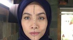Parodė, kaip pigiai panaikinti veido raukšles: moterys sužavėtos  (nuotr. asmeninio albumo („Facebook“)