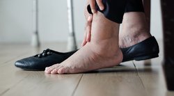 Tinsta kojos? Tai gali išduoti klastingą būklę (nuotr. Shutterstock.com)