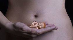 Abortas (nuotr. 123rf.com)
