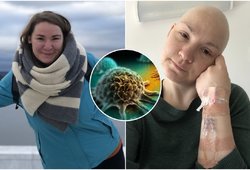 Nekaltas simptomas Monikai išdavė agresyvų vėžį: siunčia įspėjimą kitiems