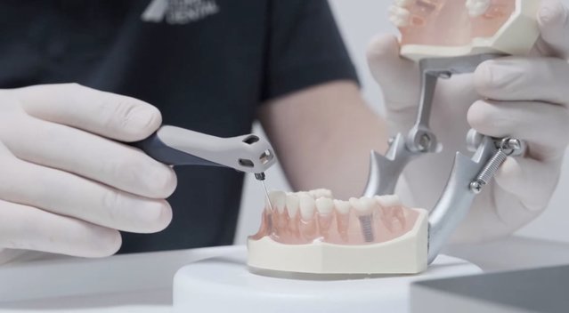 Šiems gyventojams dantų protezavimas priklauso nemokamai: štai, ką reikia žinoti  (nuotr. stop kadras)