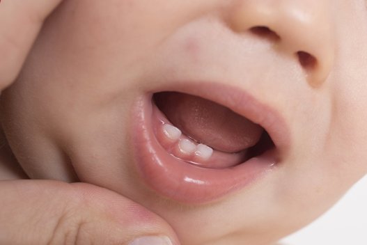 Pieniniai dantys (nuotr. Shutterstock.com)