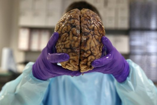 Mokslininkai aptiko smegenų sritį, kurią pažeidus išauga religingumas (nuotr. SCANPIX)