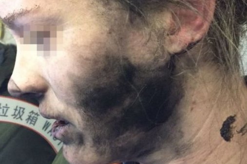 Į Australiją skridusiame lėktuve sprogus ausinių akumuliatoriui sužeista moteris (nuotr. YouTube)
