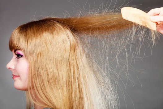 Įsielektrinę plaukai (nuotr. Shutterstock.com)