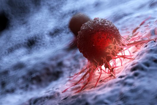 Vėžio ląstelės  (nuotr. 123rf.com)
