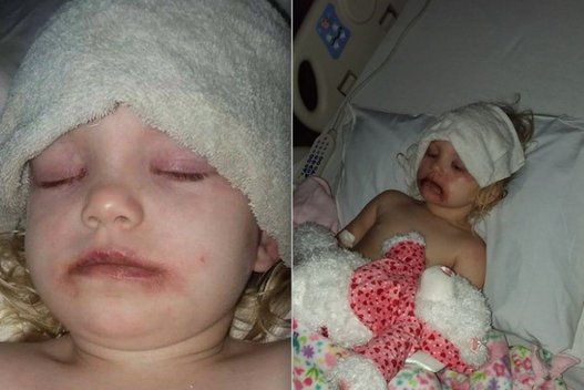 Košmarą patyrusios 3-metės mama kreipiasi į žmones: paviešino šias nuotraukas  