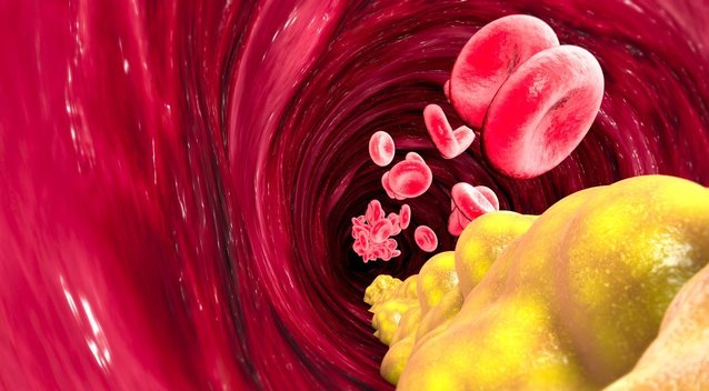 Sumažinkite aukštą cholesterolį: išbandykite 2 produktus (nuotr. Shutterstock.com)
