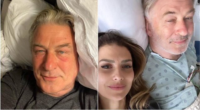 65-erių aktoriui Alecui Baldwinui atlikta operacija (nuotr. Instagram)