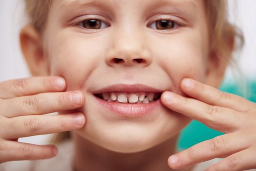 Patikrinkite savo dantis: šių dėmių negalima ignoruoti (nuotr. Fotolia)  