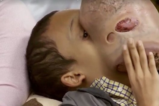 Pasaulis žiūri sulaikęs kvapą: ar pavyks išgelbėti šį auglio žalojamą berniuką? (nuotr. YouTube)