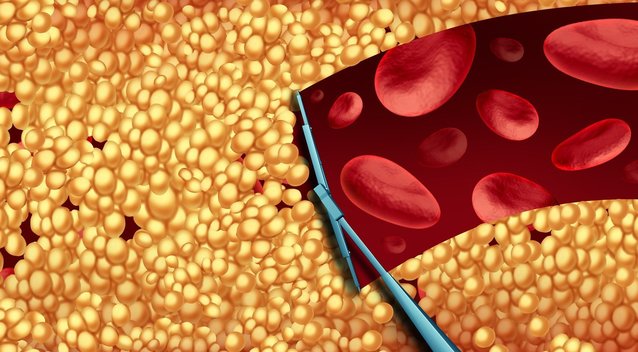 Šias uogas vadina aukso gysla organizmui: mažina net aukštą cholesterolį (nuotr. 123rf.com)