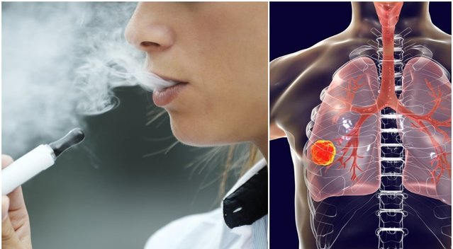 Medikė įspėja dėl lietuvių pamėgto rūkymo būdo: jokių garantijų, kad saugiau, o vėžio rizika auga (tv3.lt fotomontažas)