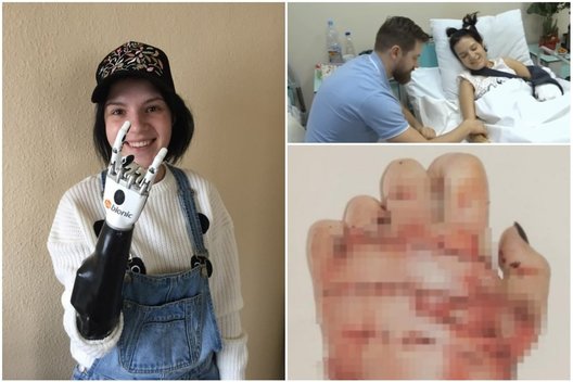 Moteris, kuriai vyras nukapojo rankas, parodė, kaip atrodo dabar (nuotr. VK.com)