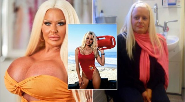 Moteris išleido tūkstančius, kad atrodytų kaip Pamela Anderson: dėl vieno jos nekenčia (tv3.lt koliažas)