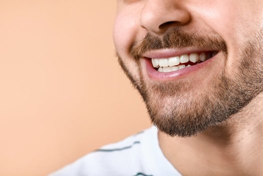 Šypsena (nuotr. Shutterstock.com)