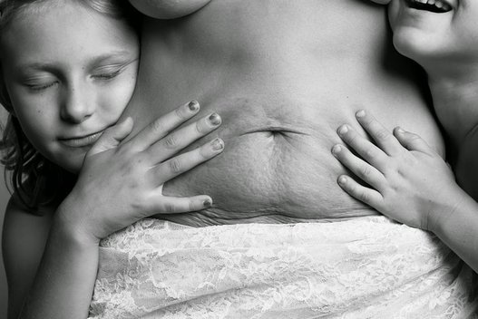 Štai kaip atrodo moters kūnas po gimdymo (viral-posts.com)  