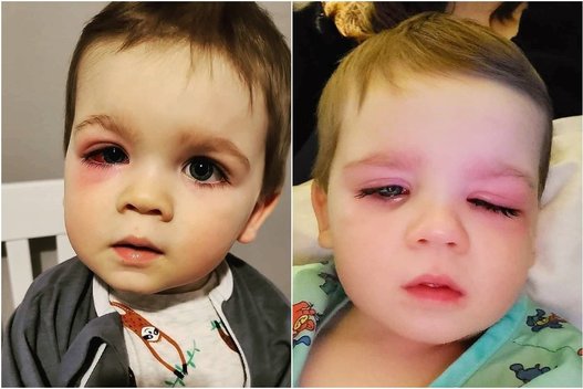 Berniuko akis ištino po to, kai į ją pateko vandens iš vonios žaislo (nuotr. Instagram)