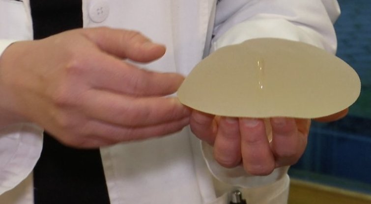 Krūtų implantai (nuotr. stop kadras)