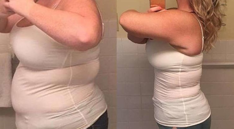 Moteris atsikratė 50 kg (nuotr. asmeninio albumo („Facebook“)