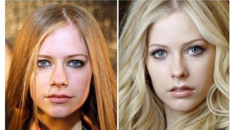 Avril Lavigne veido pokyčiai (nuotr. Twitter)