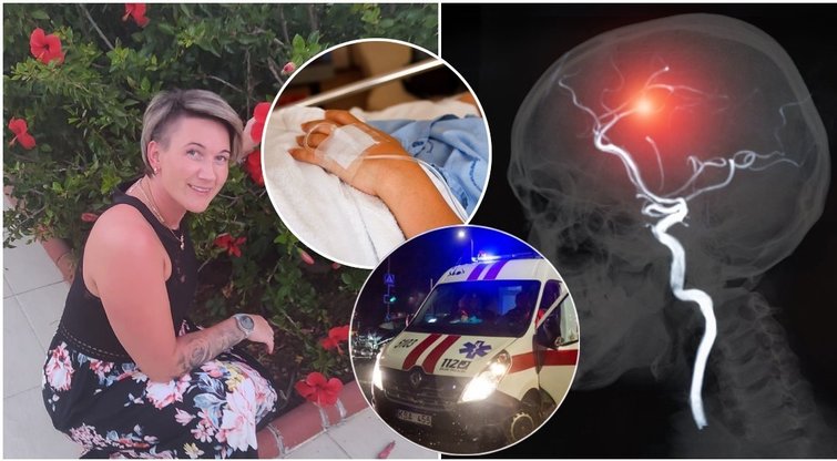 Smegenų aneurizmą 27-erių Julijai išdavė vos 1 simptomas: perspėja visus (nuotr. tv3.lt fotomontažas)  