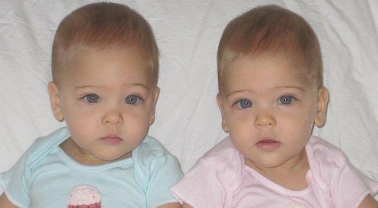 Šios dvynės laikomos gražiausiomis pasaulyje: pamatykite, kaip jos atrodo (nuotr. facebook.com)