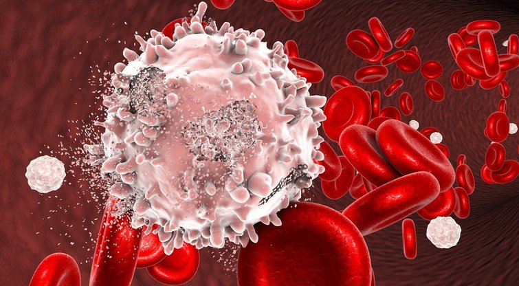 Leukemija  (nuotr. Shutterstock.com)