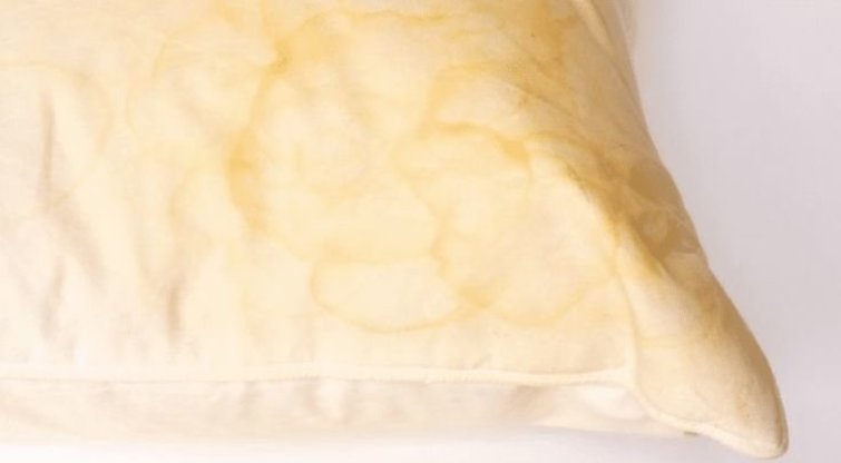 Pageltusių dėmių ant pagalvės neliks nė kvapo: štai, ką reikia daryti (nuotr. pinterest.com)