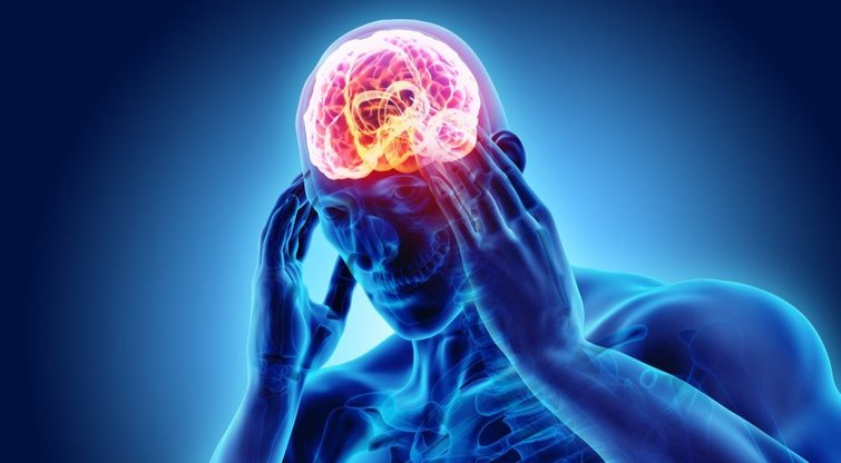 Galvos skausmas  (nuotr. Shutterstock.com)